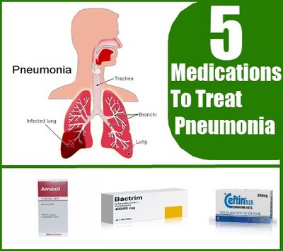 How to Treat Pneumonia